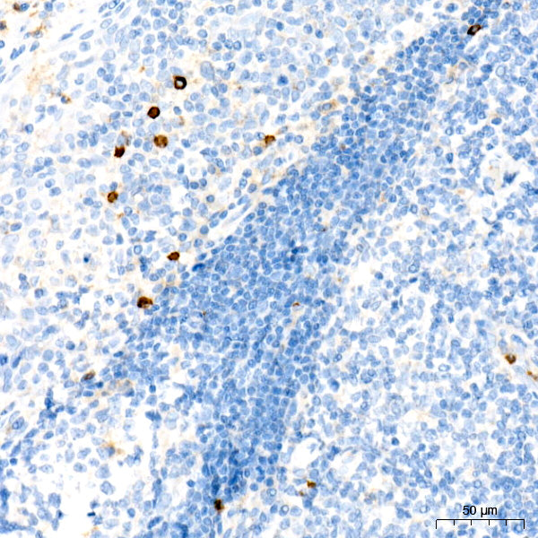 CD63 Rabbit mAb