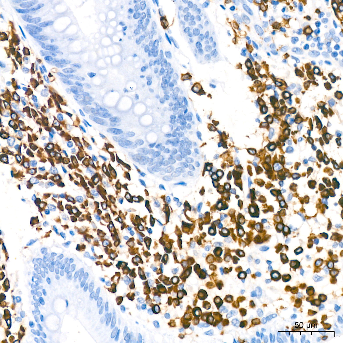CD79a Rabbit mAb