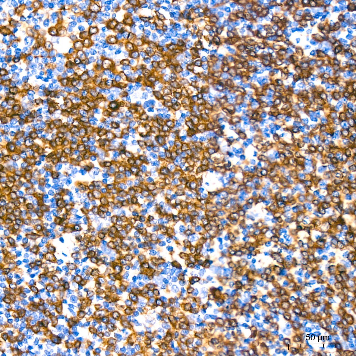 CD79a Rabbit mAb