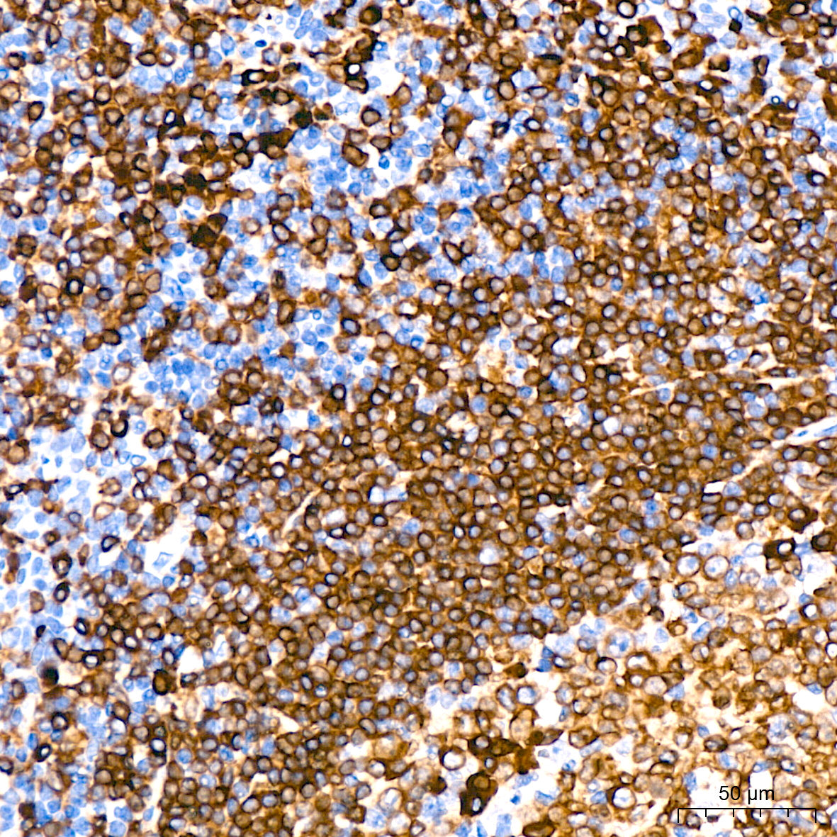 CD79a Rabbit mAb