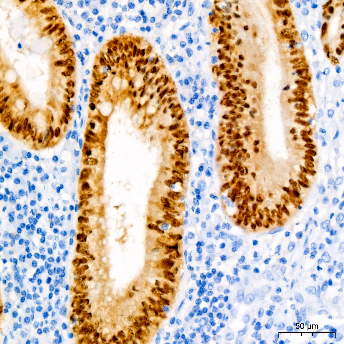[KD Validated] CDX2 Rabbit mAb
