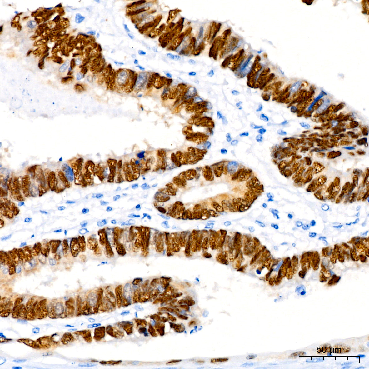 [KD Validated] CDX2 Rabbit mAb