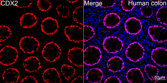 [KD Validated] CDX2 Rabbit mAb