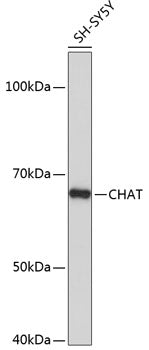 ChAT Rabbit mAb