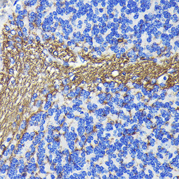 CNPase Rabbit mAb
