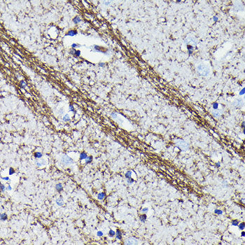 CNPase Rabbit mAb