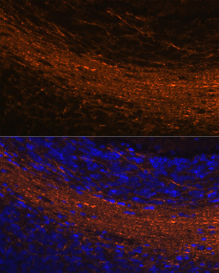 CNPase Rabbit mAb