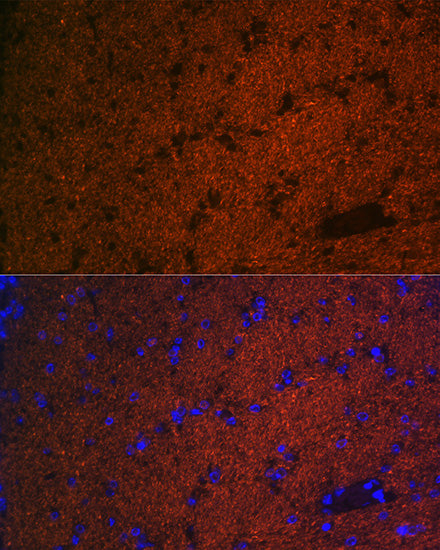 CNPase Rabbit mAb
