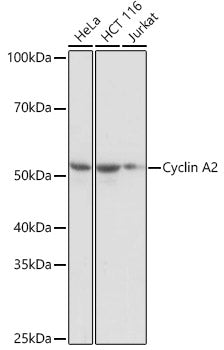 Cyclin A2 Rabbit mAb