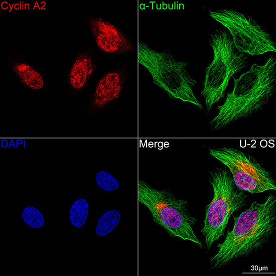 Cyclin A2 Rabbit mAb