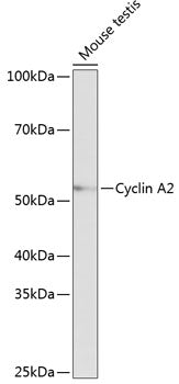 Cyclin A2 Rabbit mAb