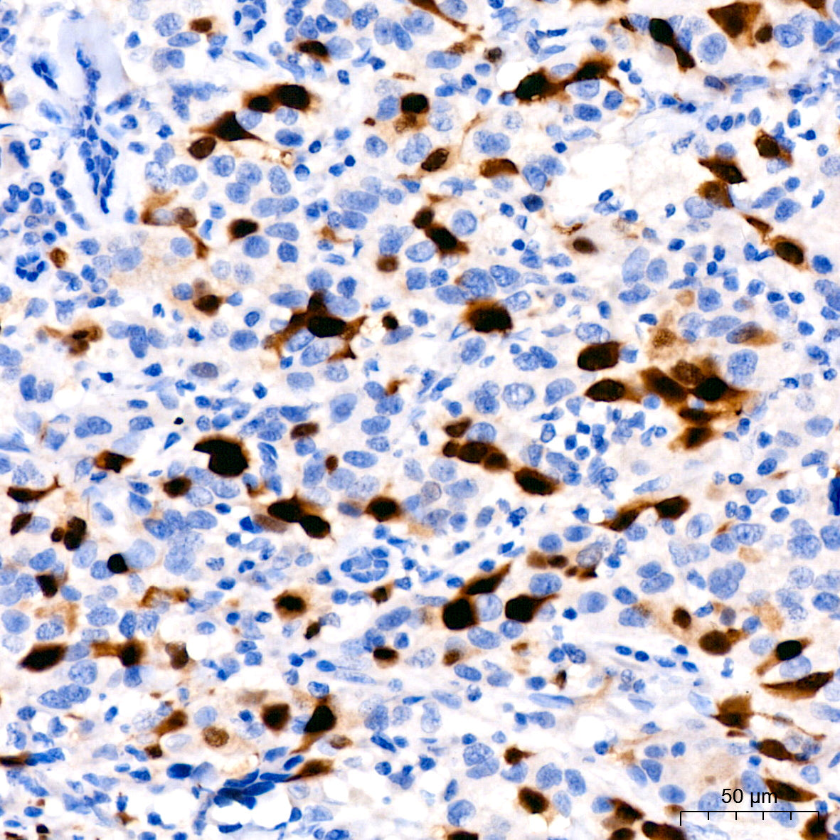 Cyclin A2 Rabbit mAb
