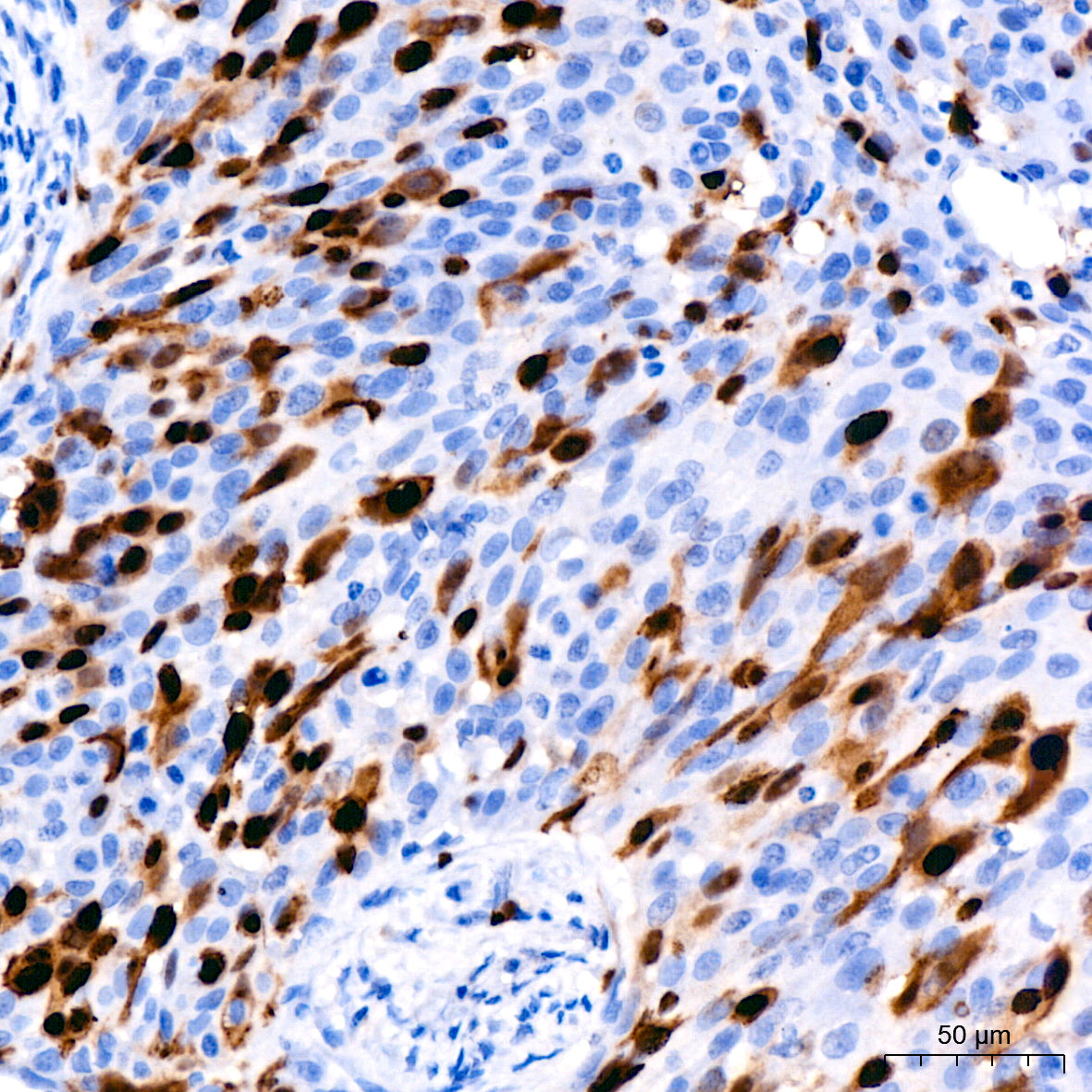 Cyclin A2 Rabbit mAb