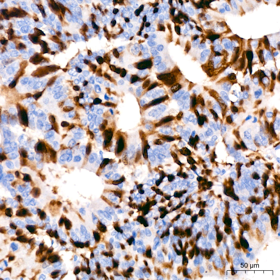 Cyclin A2 Rabbit mAb