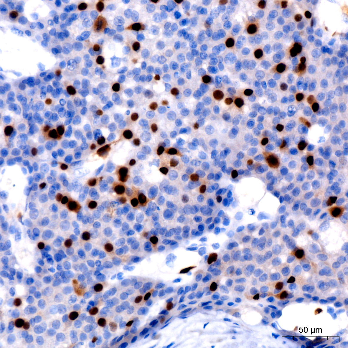 Cyclin A2 Rabbit mAb