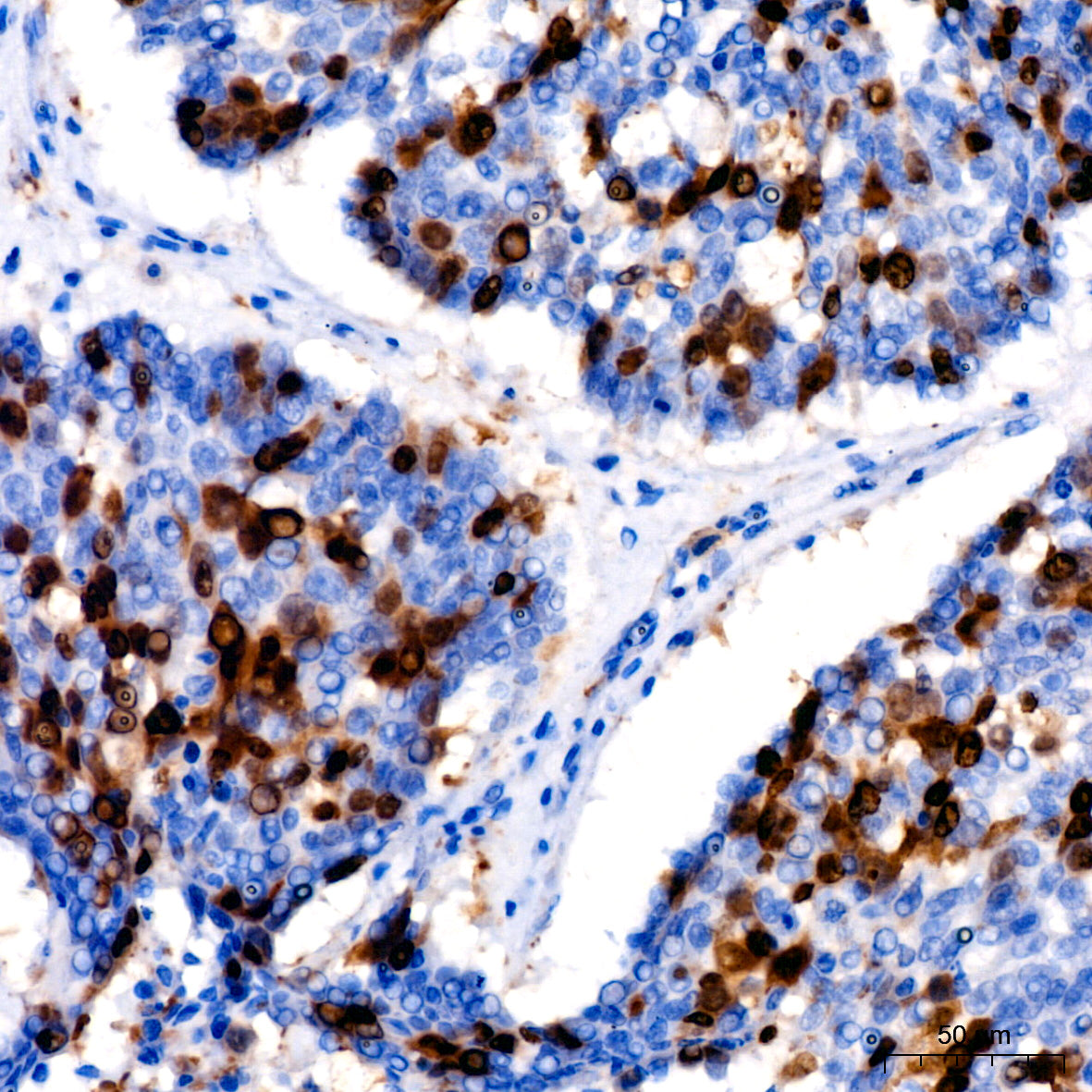 Cyclin A2 Rabbit mAb