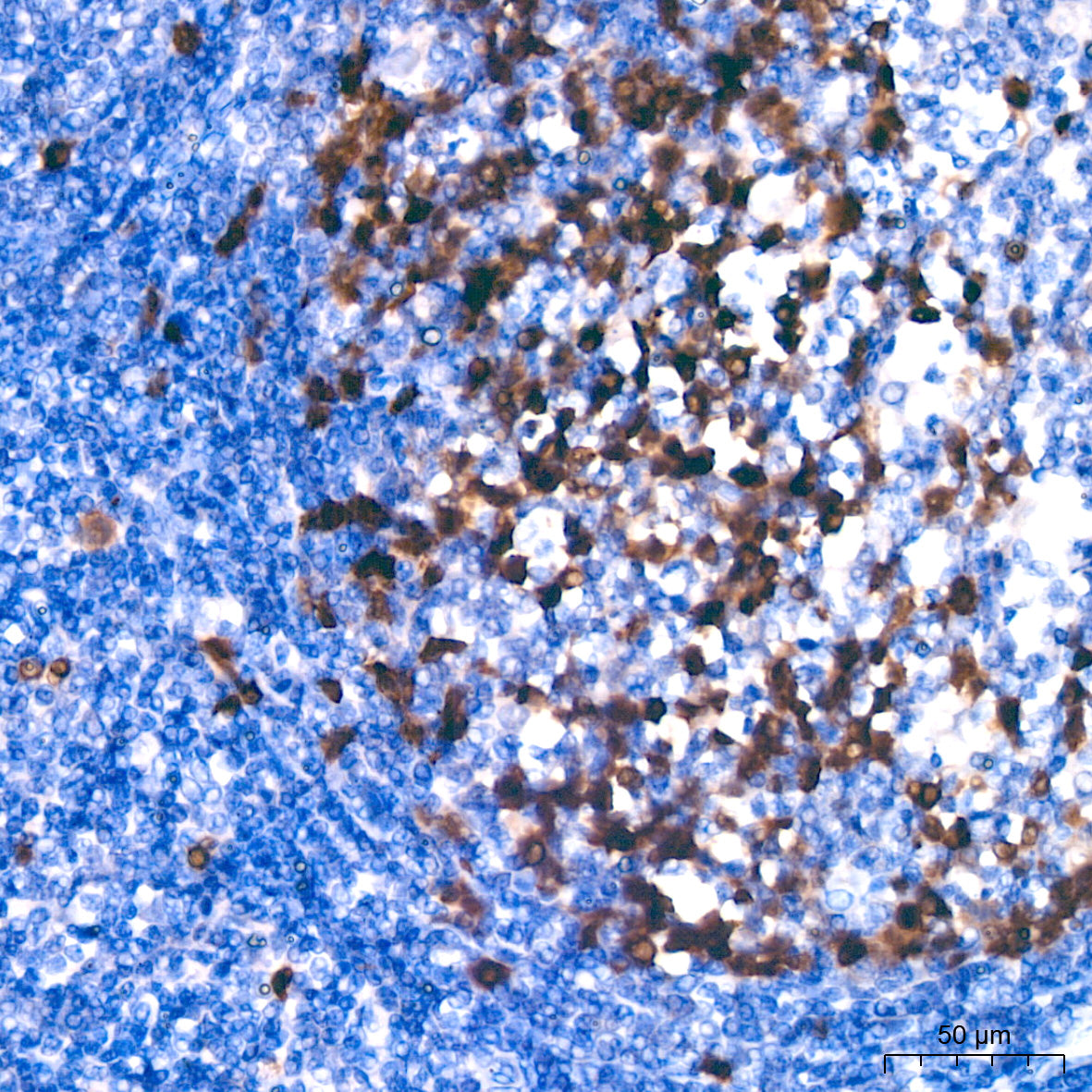 Cyclin A2 Rabbit mAb
