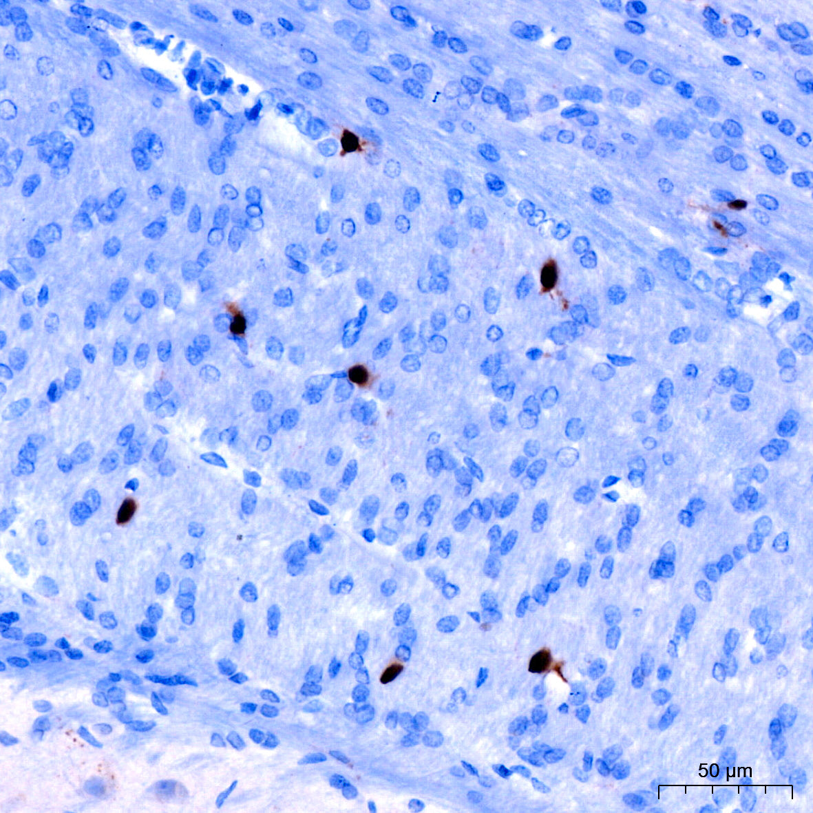 Cyclin A2 Rabbit mAb