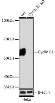 [KO Validated] Cyclin B1 Rabbit mAb