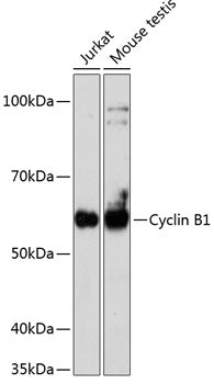 [KO Validated] Cyclin B1 Rabbit mAb