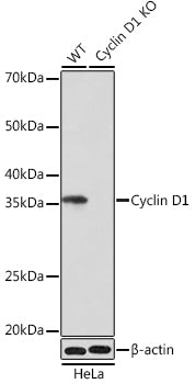 [KO Validated] Cyclin D1 Rabbit mAb