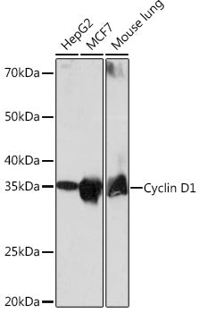 [KO Validated] Cyclin D1 Rabbit mAb