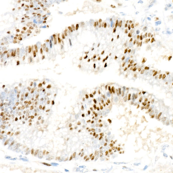 [KO Validated] Cyclin D1 Rabbit mAb