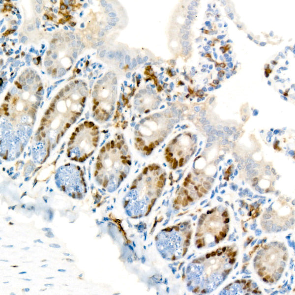 [KO Validated] Cyclin D1 Rabbit mAb