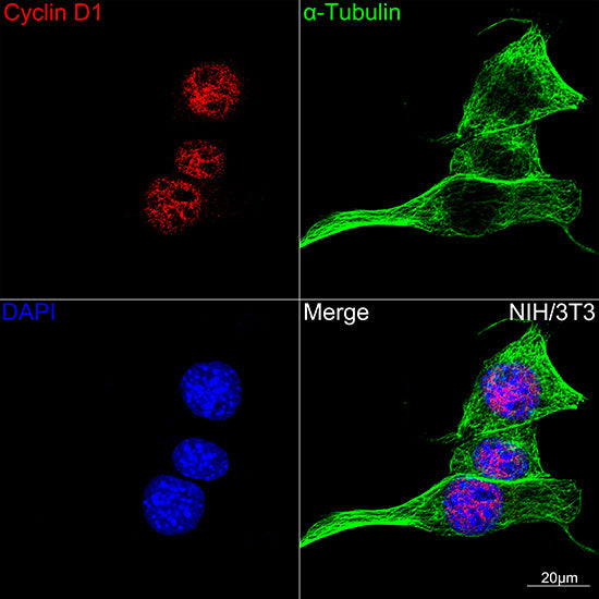 [KO Validated] Cyclin D1 Rabbit mAb