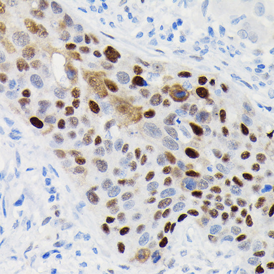 [KO Validated] Cyclin D1 Rabbit mAb