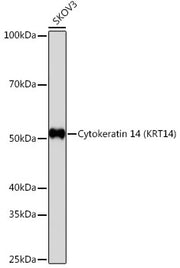 Cytokeratin 14 (KRT14) Rabbit mAb