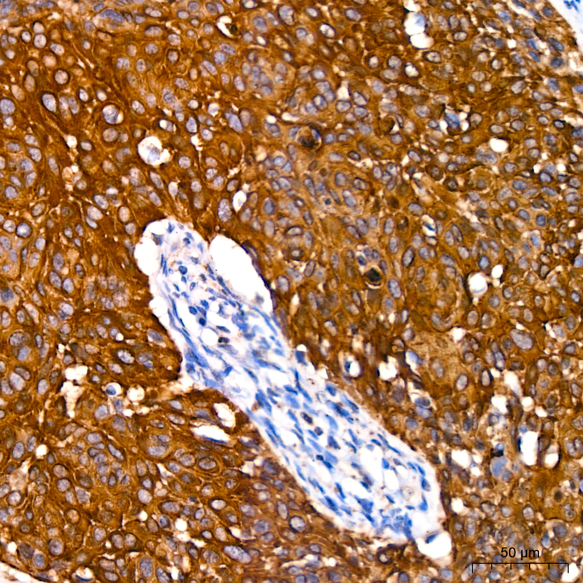 Cytokeratin 14 (KRT14) Rabbit mAb