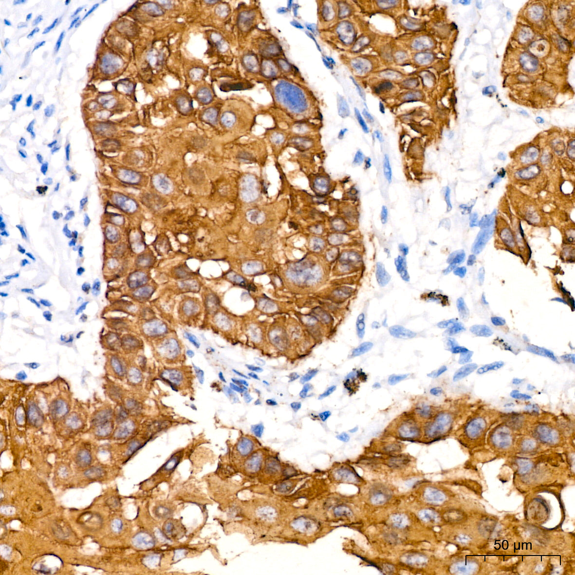 Cytokeratin 14 (KRT14) Rabbit mAb