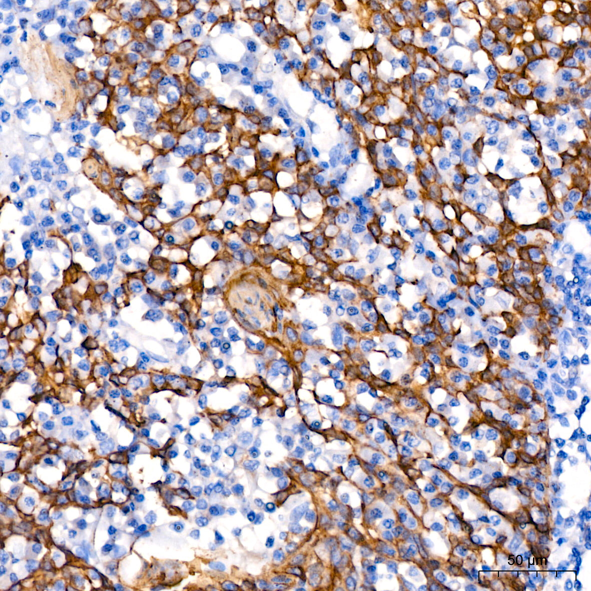 Cytokeratin 14 (KRT14) Rabbit mAb