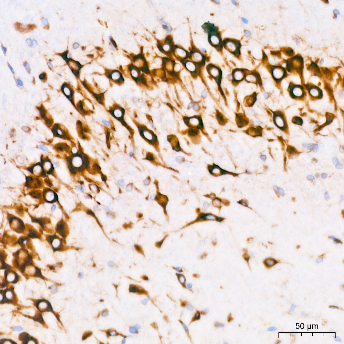 Cytokeratin 14 (KRT14) Rabbit mAb