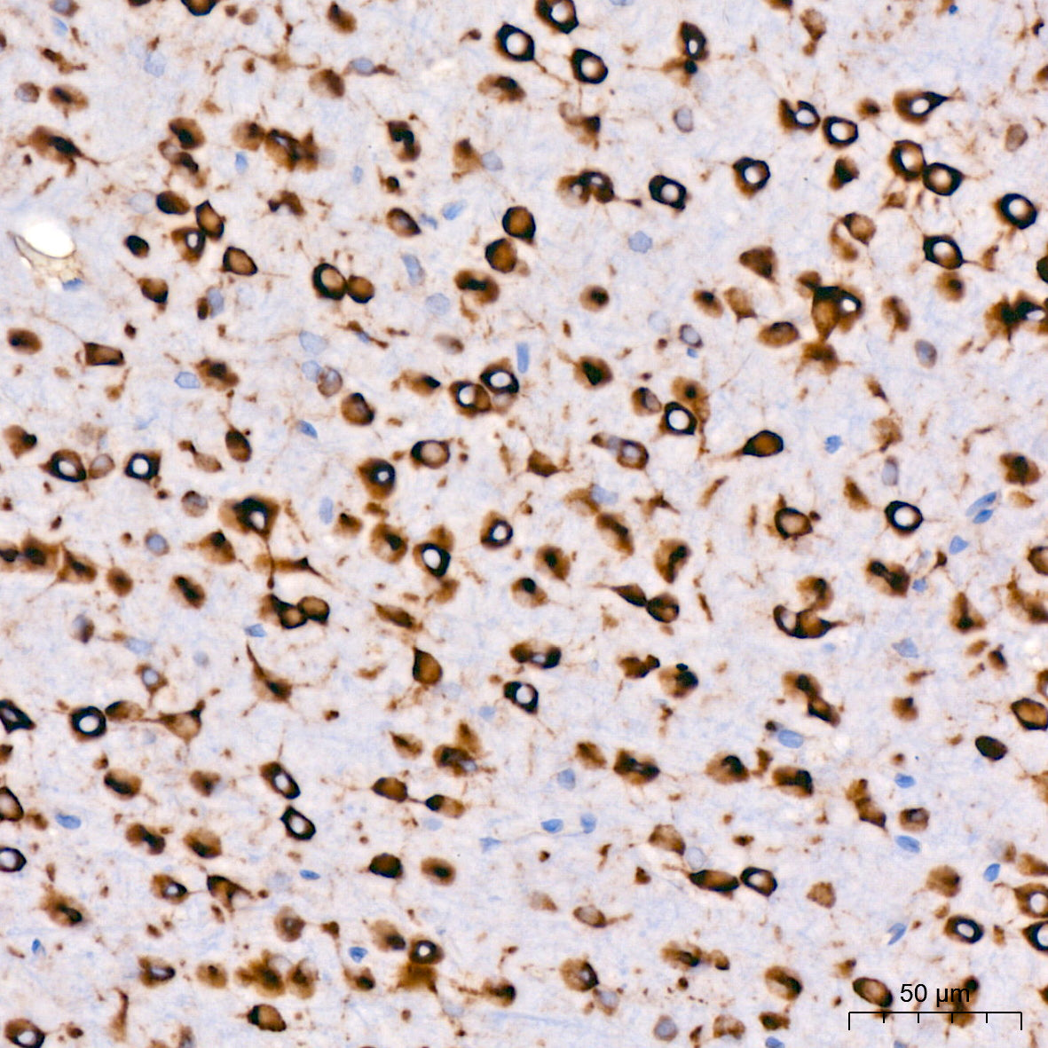 Cytokeratin 14 (KRT14) Rabbit mAb
