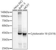 Cytokeratin 19 (CK19) Rabbit mAb