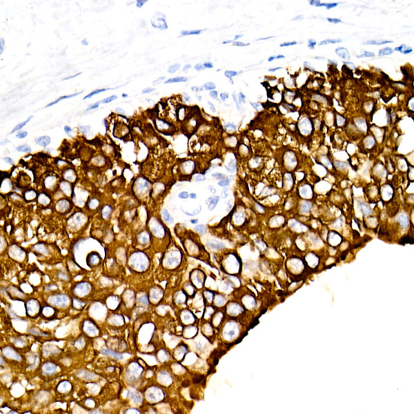 Cytokeratin 19 (CK19) Rabbit mAb
