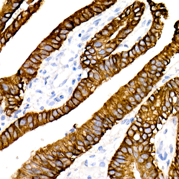 Cytokeratin 19 (CK19) Rabbit mAb