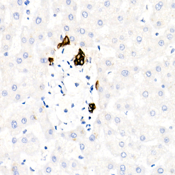 Cytokeratin 19 (CK19) Rabbit mAb