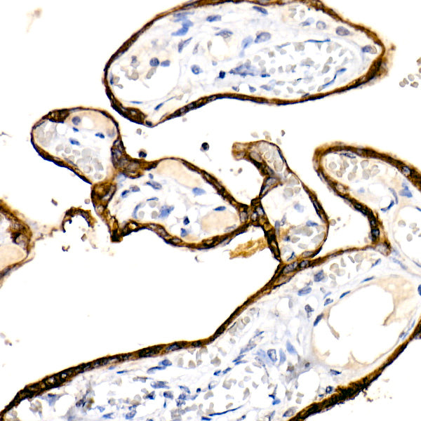 Cytokeratin 19 (CK19) Rabbit mAb