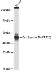 Cytokeratin 20 (CK20) Rabbit mAb