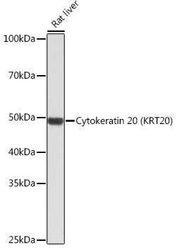 Cytokeratin 20 (CK20) Rabbit mAb