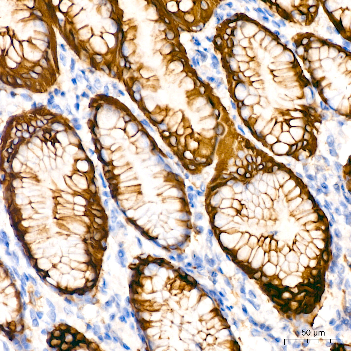 Cytokeratin 20 (CK20) Rabbit mAb