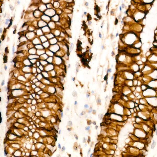 Cytokeratin 20 (CK20) Rabbit mAb