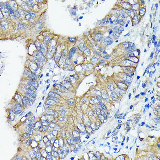 DR5/TRAILR2/TNFRSF10B Rabbit mAb