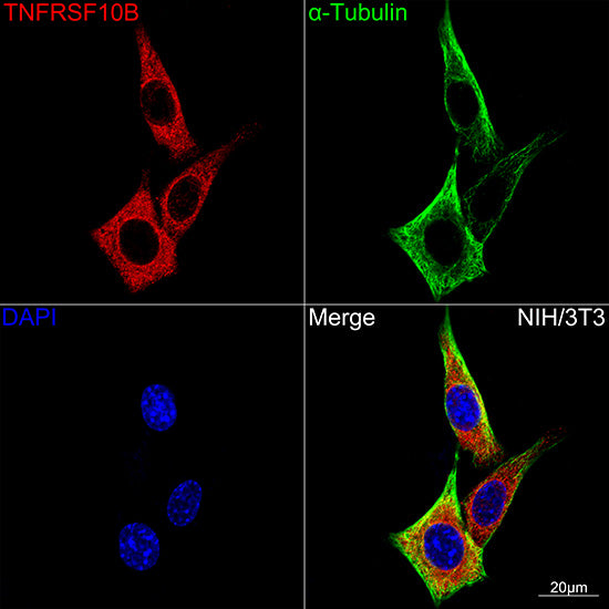 DR5/TRAILR2/TNFRSF10B Rabbit mAb