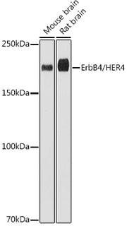 ErbB4/HER4 Rabbit mAb