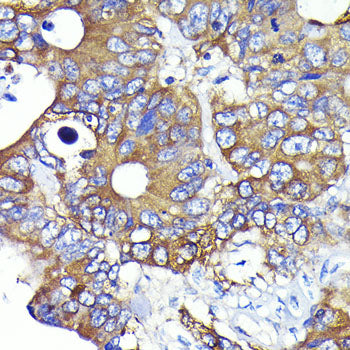Ezrin Rabbit mAb