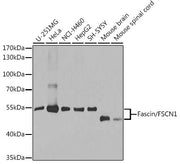 [KO Validated] Fascin/FSCN1 Rabbit pAb